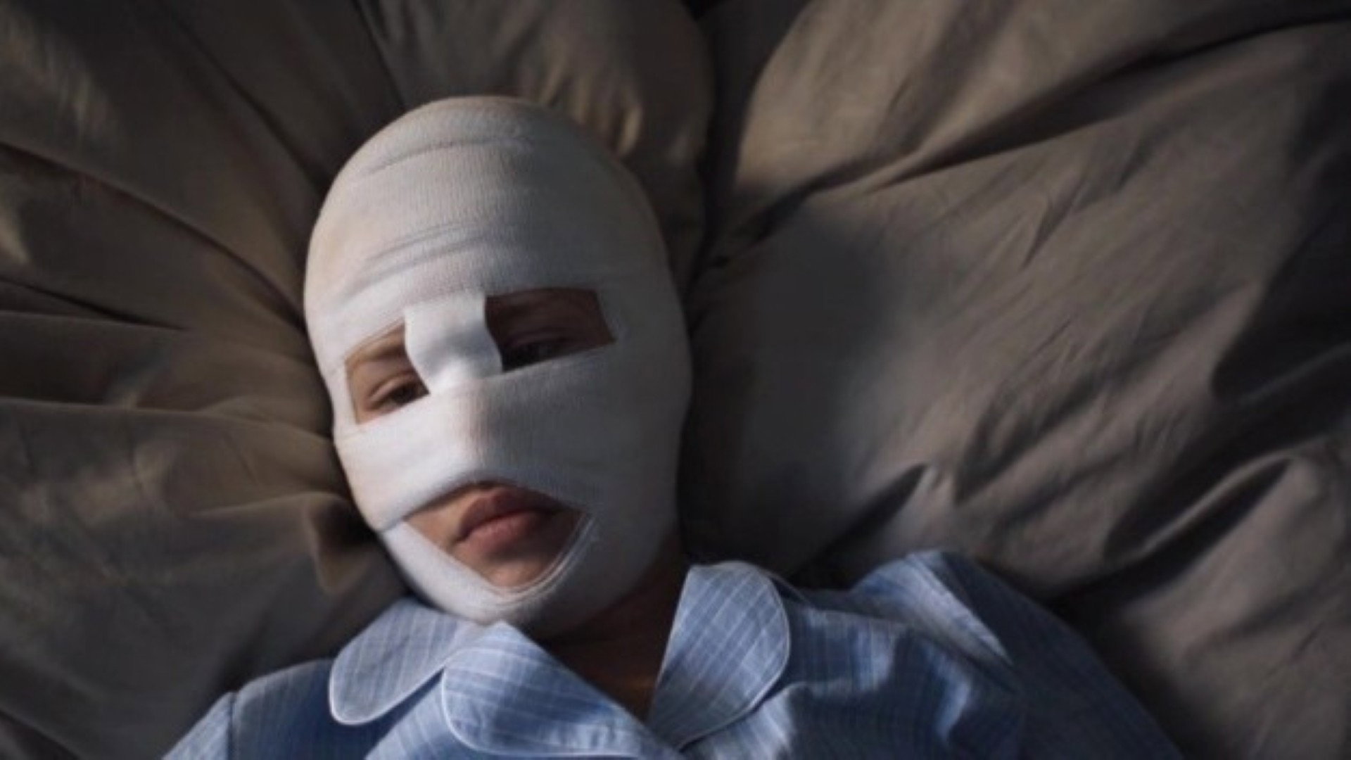 Bandaged