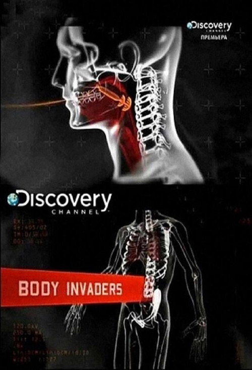 Body Invaders